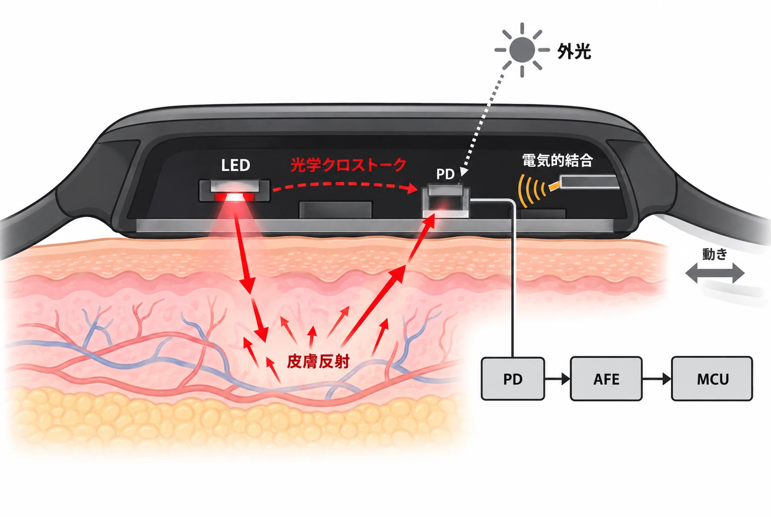 スマートバンドのPPG心拍センサーでLEDから皮膚、フォトダイオード、AFE、MCUへ信号が進む経路と、外光・光学クロストーク・基板上の電気的結合を示す模式図